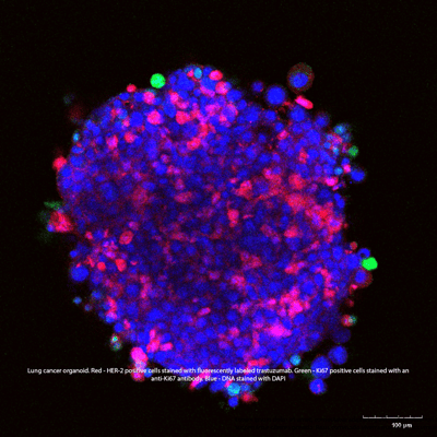 RLUN21_herceptin only_3h_10bai - with text-2