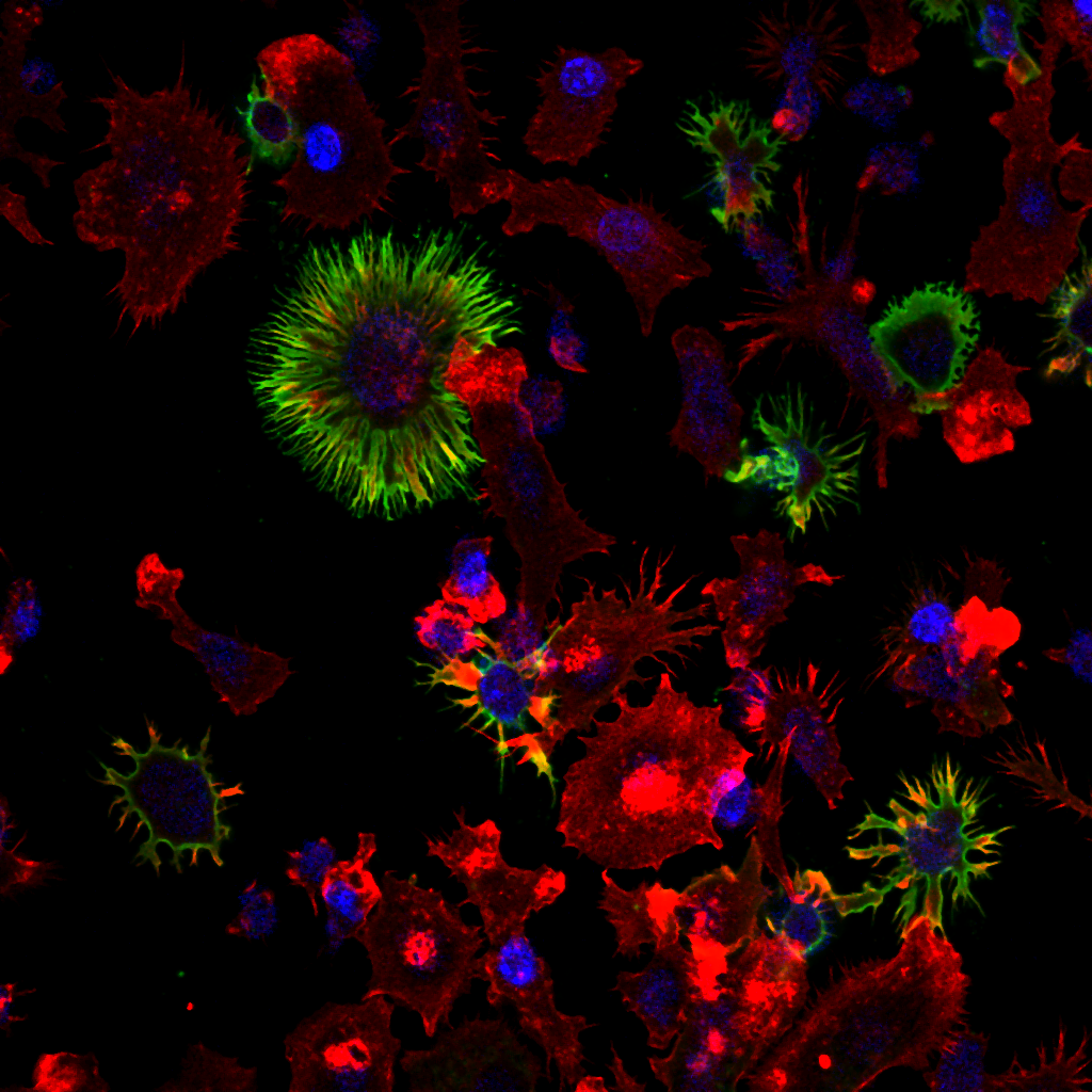 Dendritic cells (2)